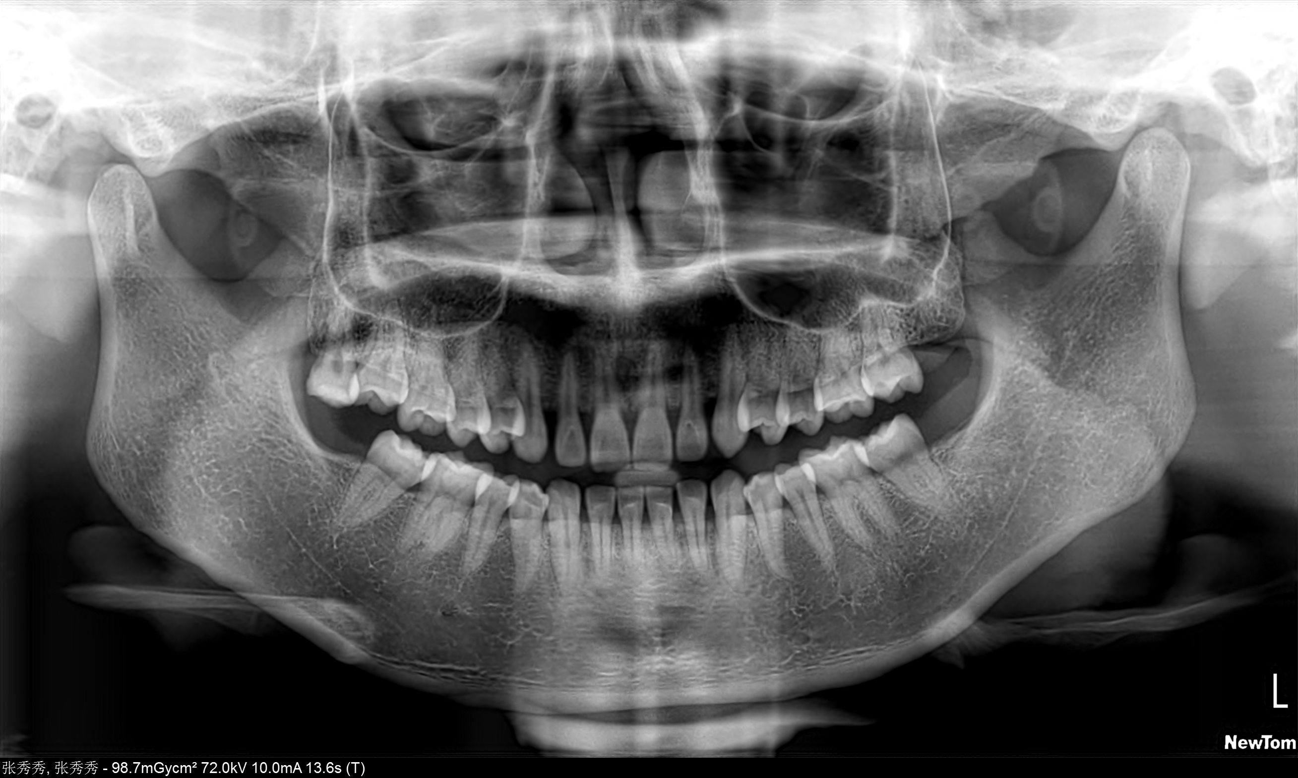 牙齿健康 免费图片 - Public Domain Pictures