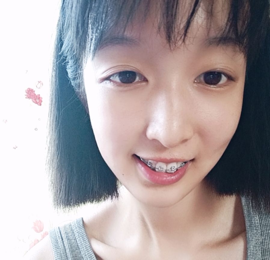 小钢牙的第296天